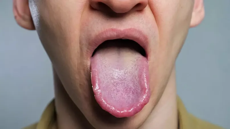 Vaper's Tongue